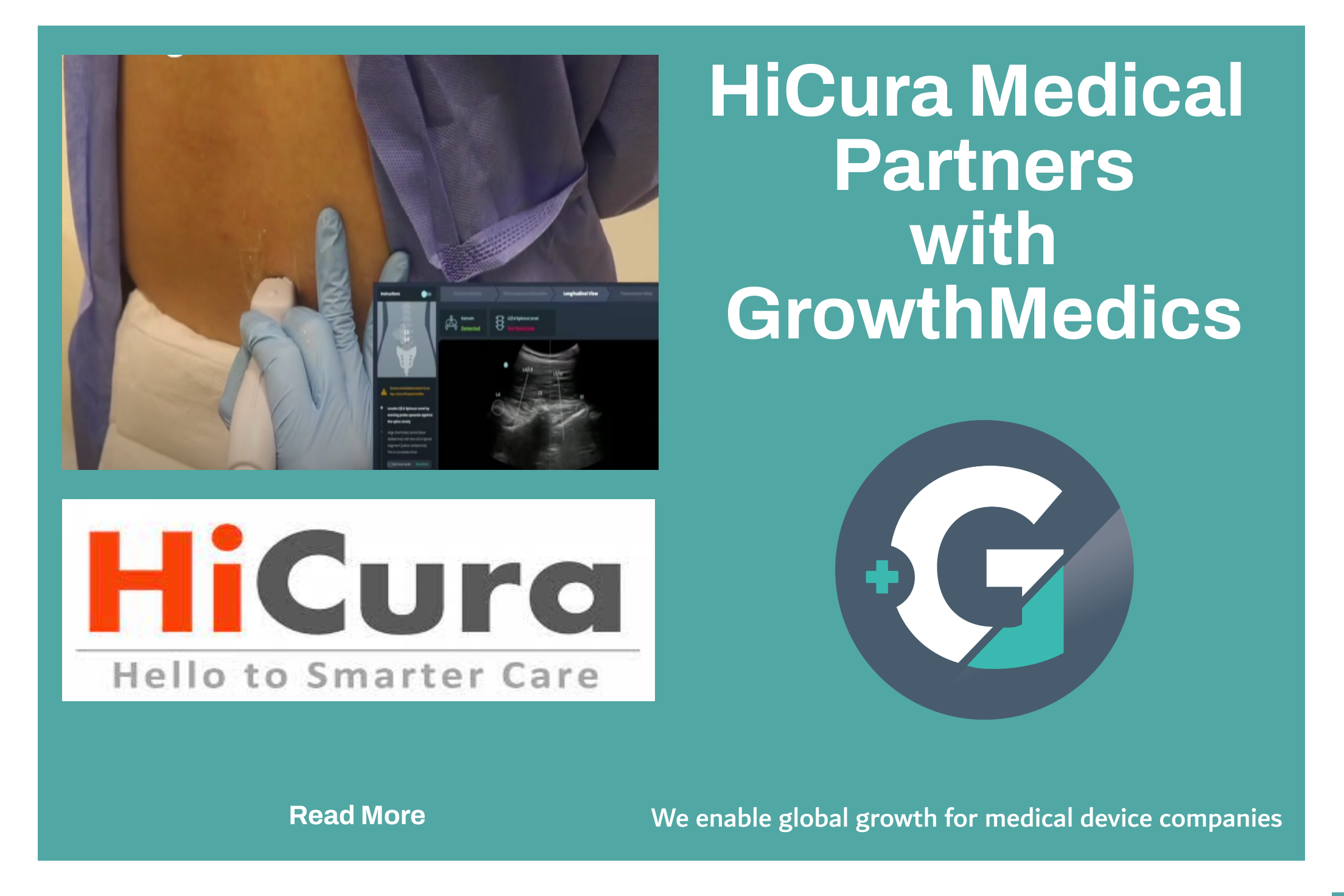 HiCura Medical Partners with GrowthMedics To Enter and Accelerate Market Growth in the European image guidance Industry  