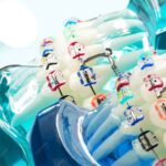 European catheter market