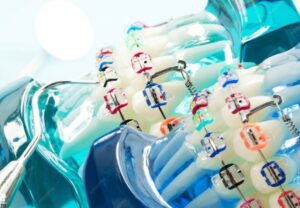 European catheter market