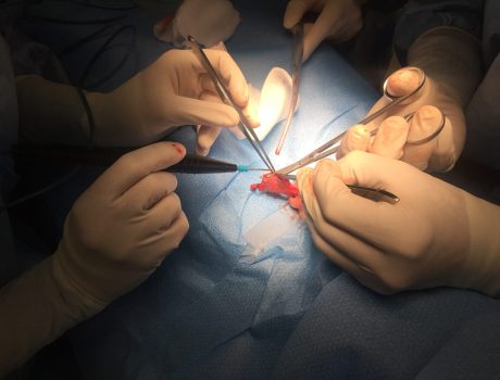 surgery-6PFDAQF surgery-6PFDAQF